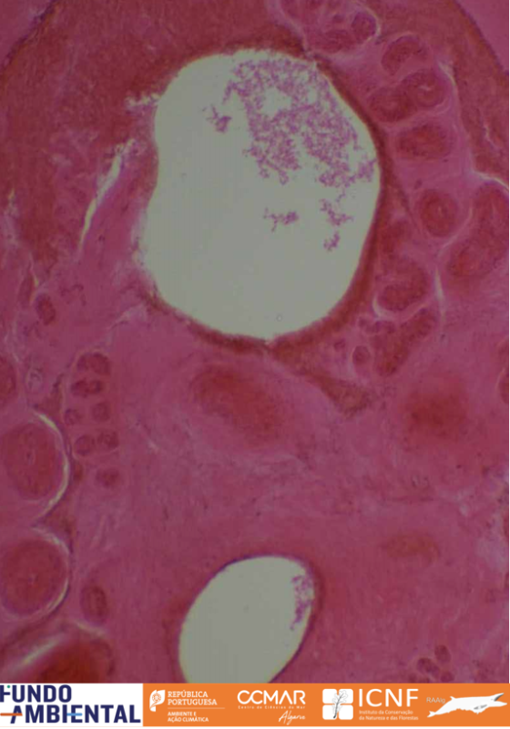 Histologia de ovário